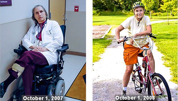 sclerosi multipla: la guarigione di Terry Wahls